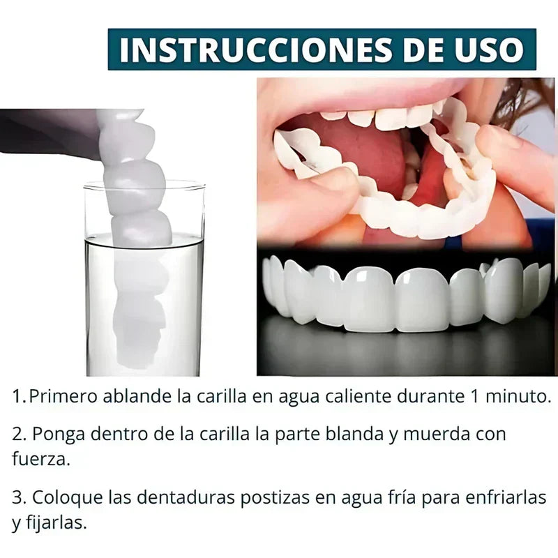SmilePro — Carillas dentales ajustables de resina